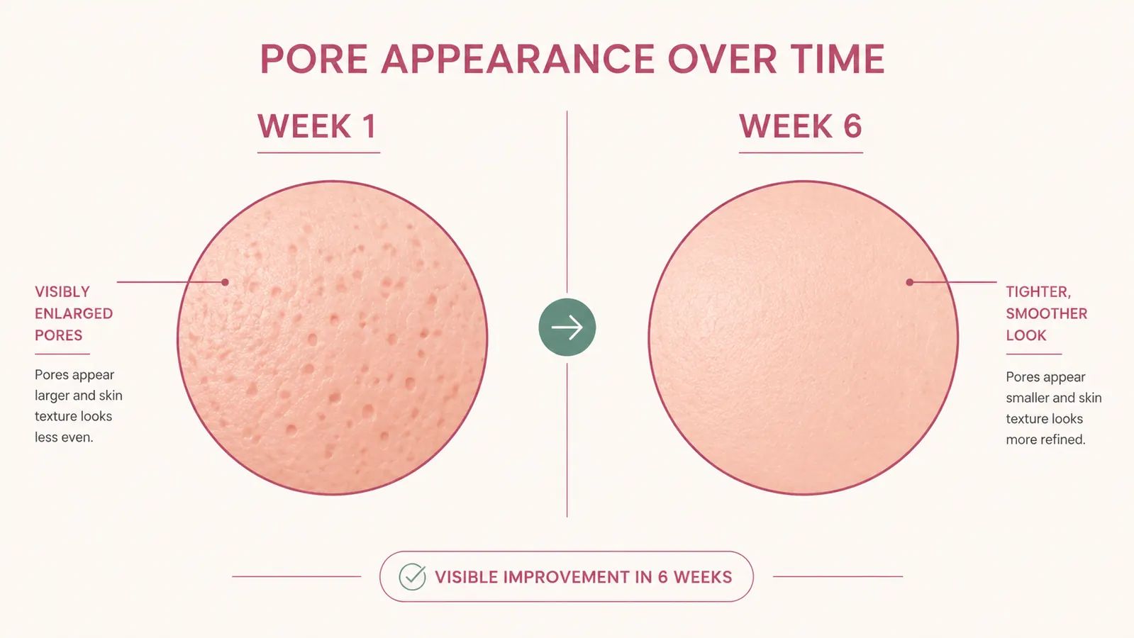 Close-up side-by-side comparison chart showing pore appearance before and after six weeks of niacinamide use, illustrated style
